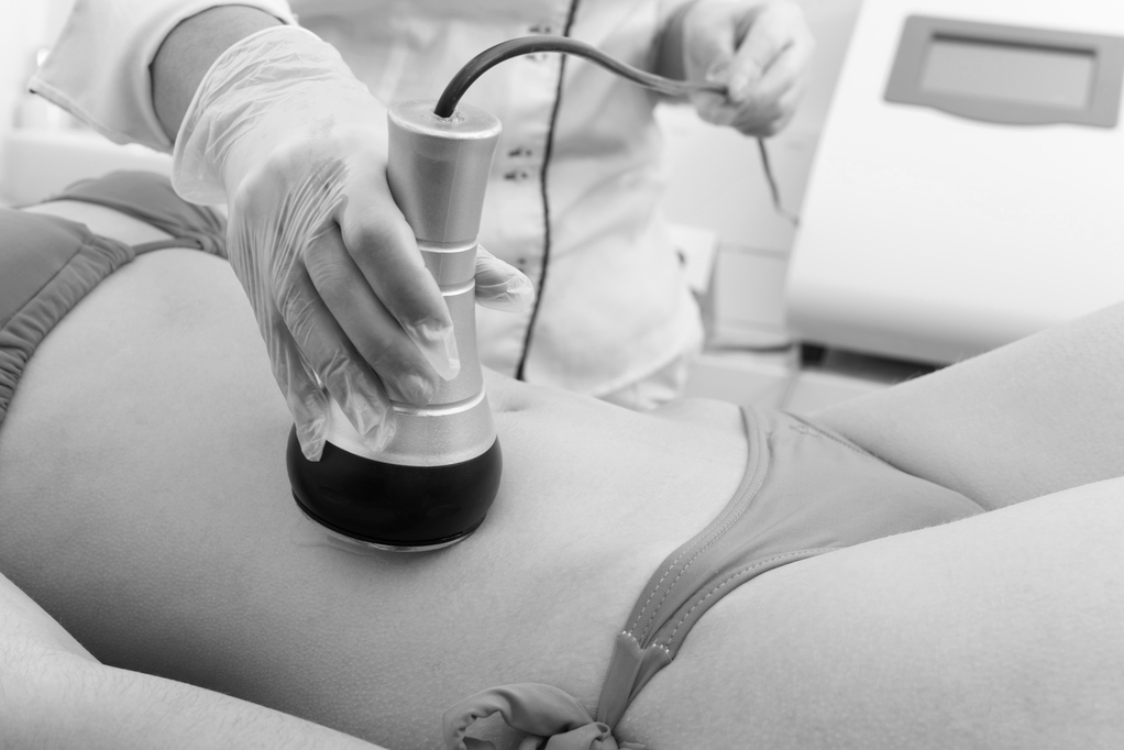 RF Radiofrequency Ultrasonic Cavitation Troy MI 248-607-7546